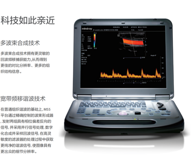 迈瑞便携超声M55